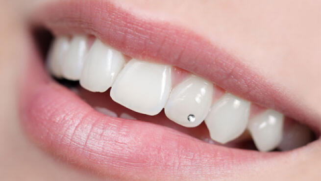 Colocacion De Brillante Dental No Invasivo Higiene Bucodental Con Pulido Por 11 90 Oferta Con Descuento 78 Ofertas En Santander Y Cantabria Oferplan El Diario Montanes